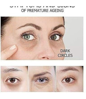 کرم دور چشم خاویار و طلای 24 عیار ونزن