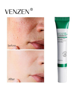 کرم سالیسیلیک اسید ونزن