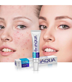 کرم ضد جوش و اکنه بیواکوا