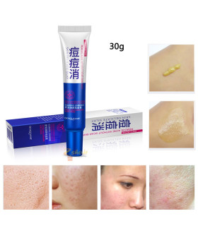 کرم ضد جوش فوری بیواکوا ا Bioaqua شهریور 1402