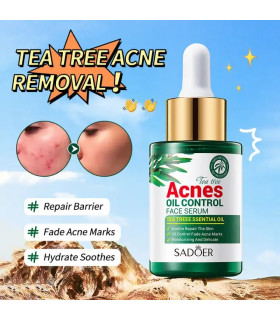 سرم چای سبز درمان جوش و آکنه سادور