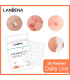پچ جوش آکنه LANBENA 25pcs