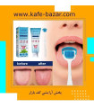 ژل زبان شور
