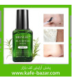 چسب ضد جوش سرسیاه بینی بریلی