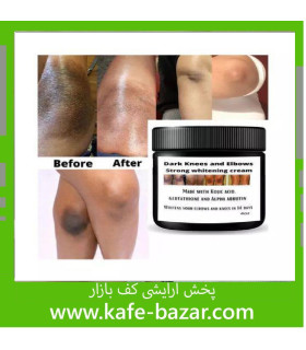 کرم کاسه ای سفید کننده بدن مویام