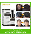 اسپری تقویوت رشد مو لانبنا ضدریزش مو Lanbena Hair Growth Essential Spray