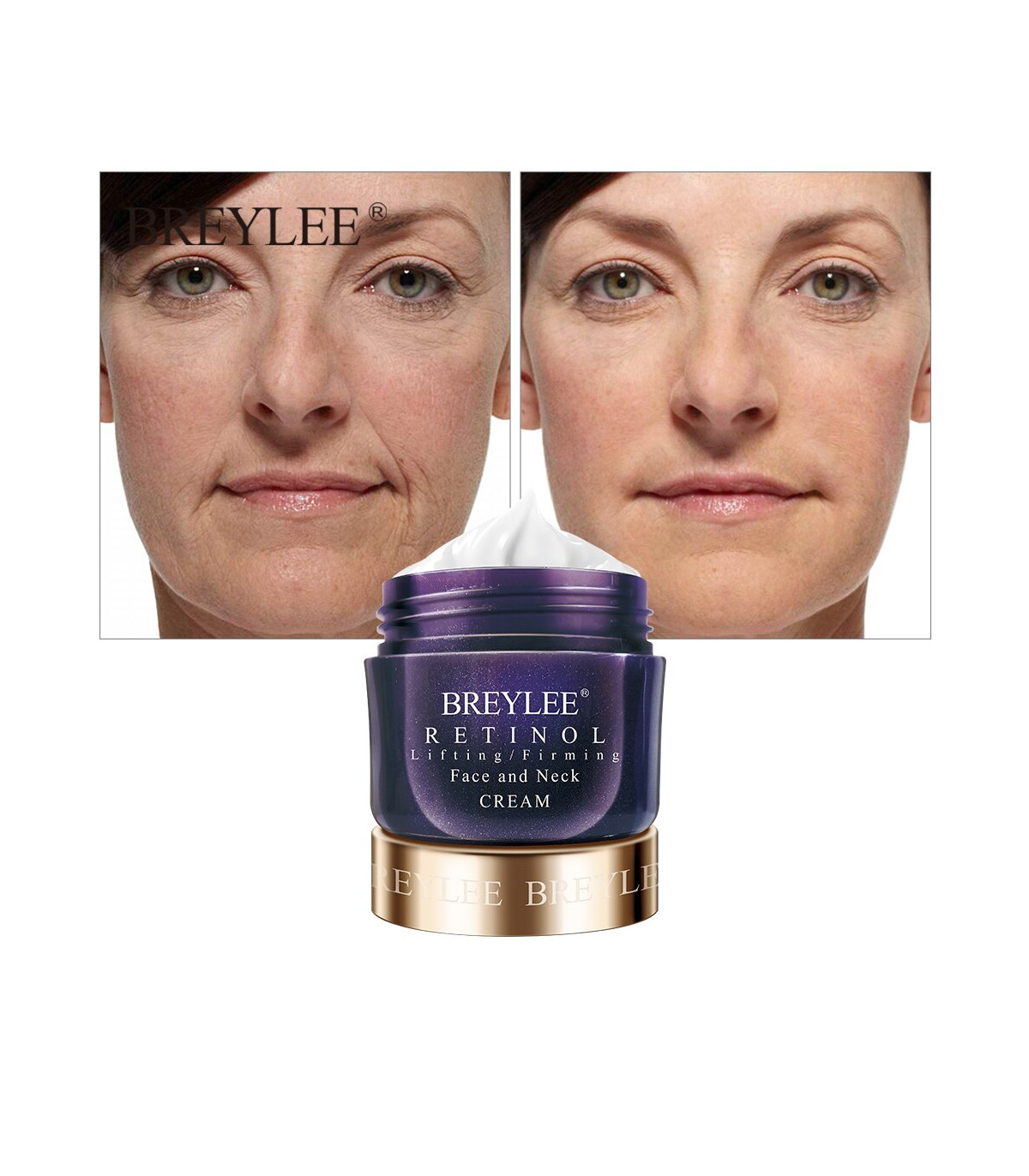 -کرم-رتینول-بریلی-breylee.jpg